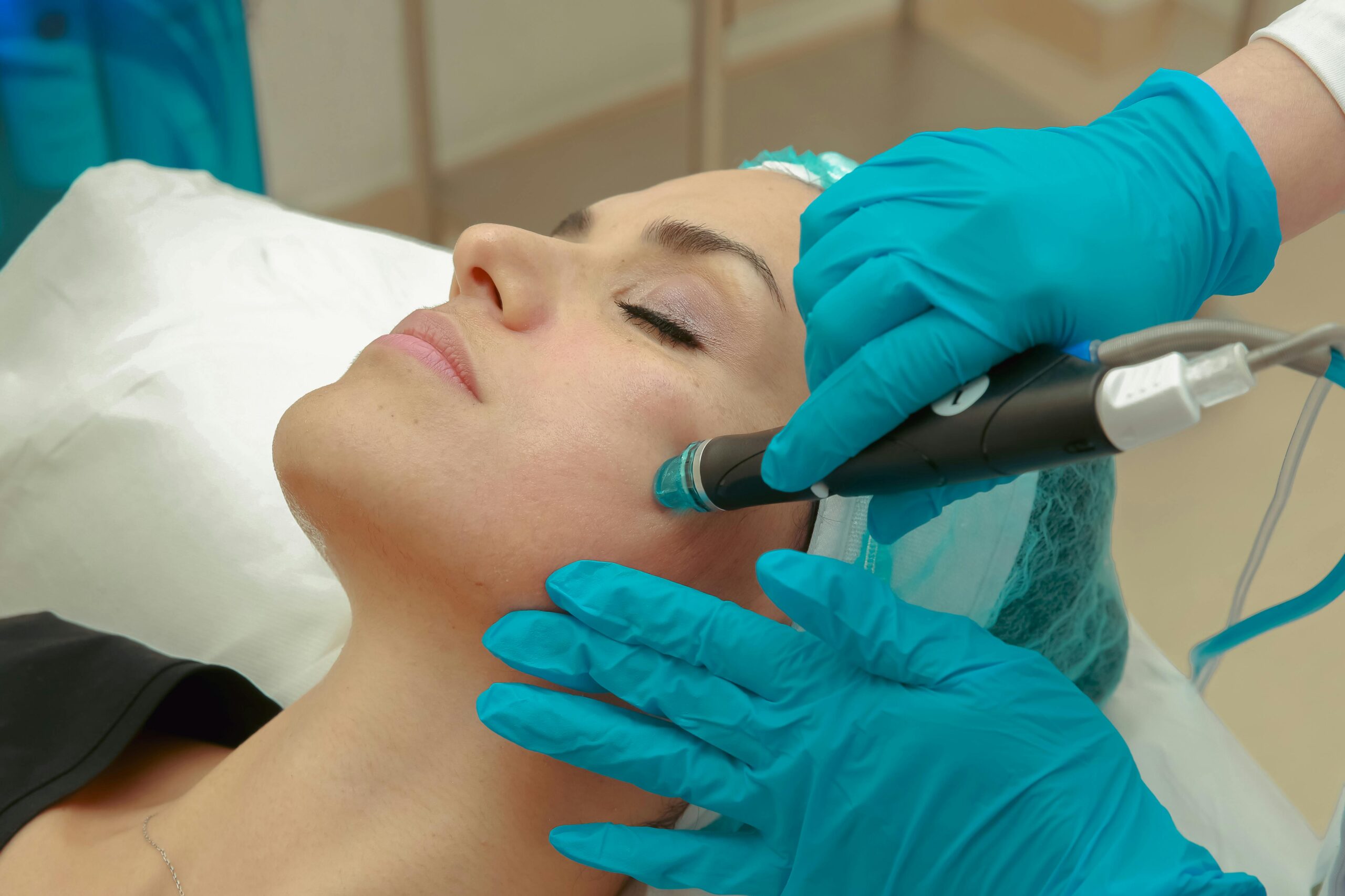 1 Radiofrecuencia fraccionada facial salón belleza Torrente Valencia