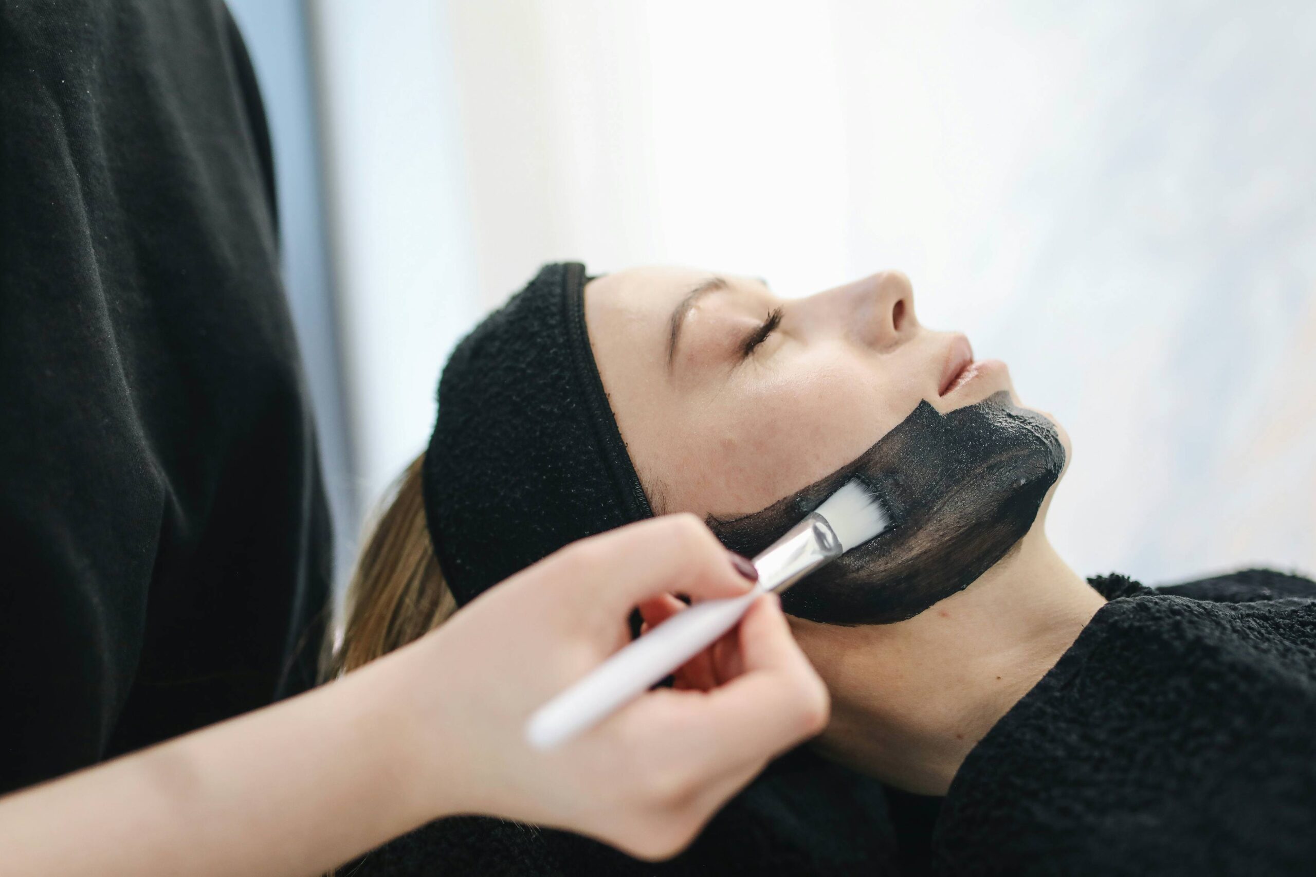 5 Carbon Peel tratamiento facial estrella Torrente Valencia